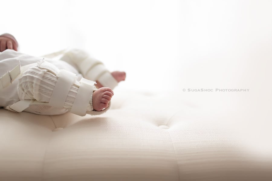 SugaShoc_Photography_baby_Photographer_Bucks_County_PA_Doylestown_PA_hip_dysplasia_close_up_of_baby_feet